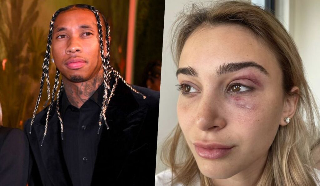 Tyga is accused of physical assault on his ex-girlfriend
