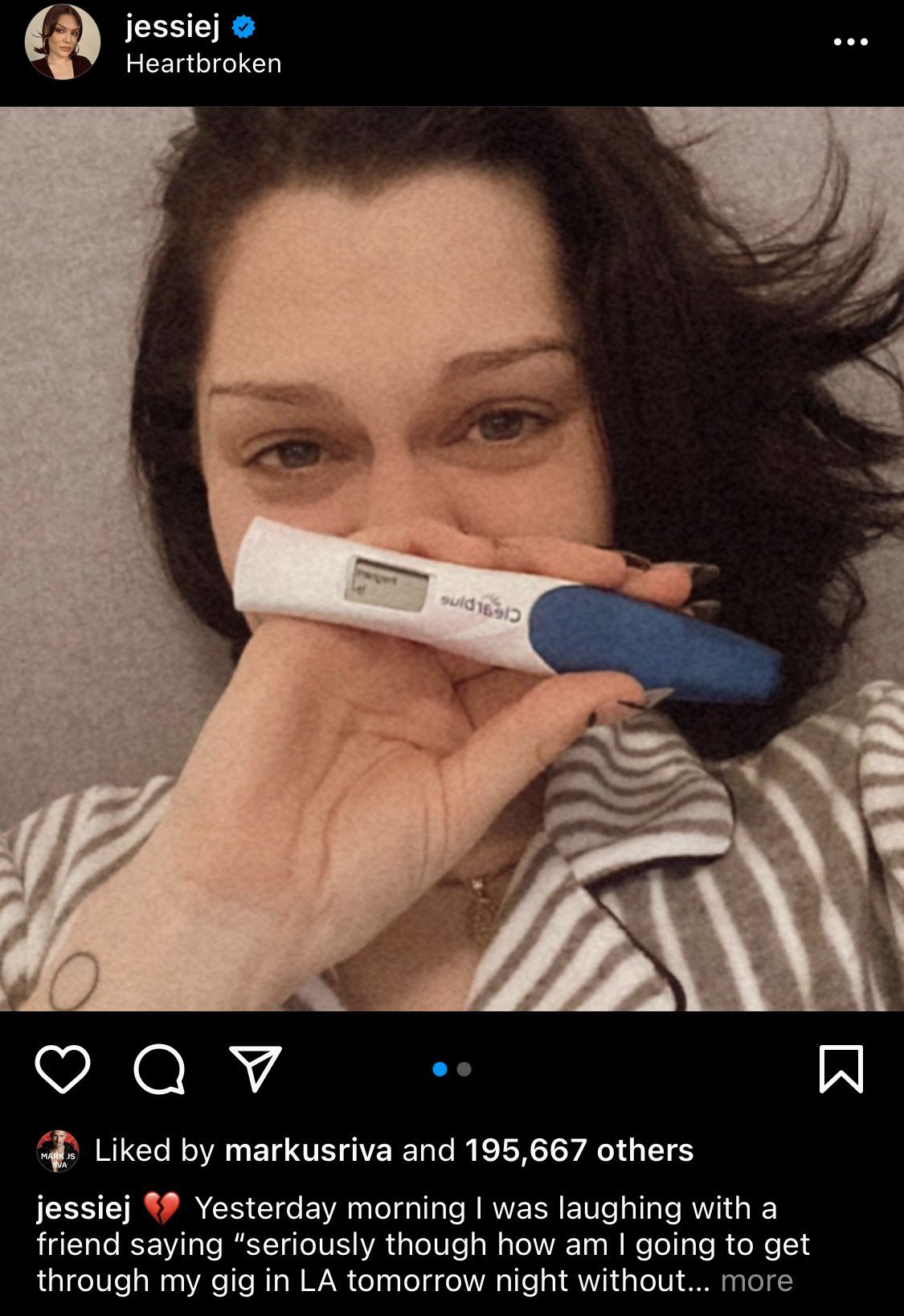 Jessie J reveals that she got pregnant and lost the baby