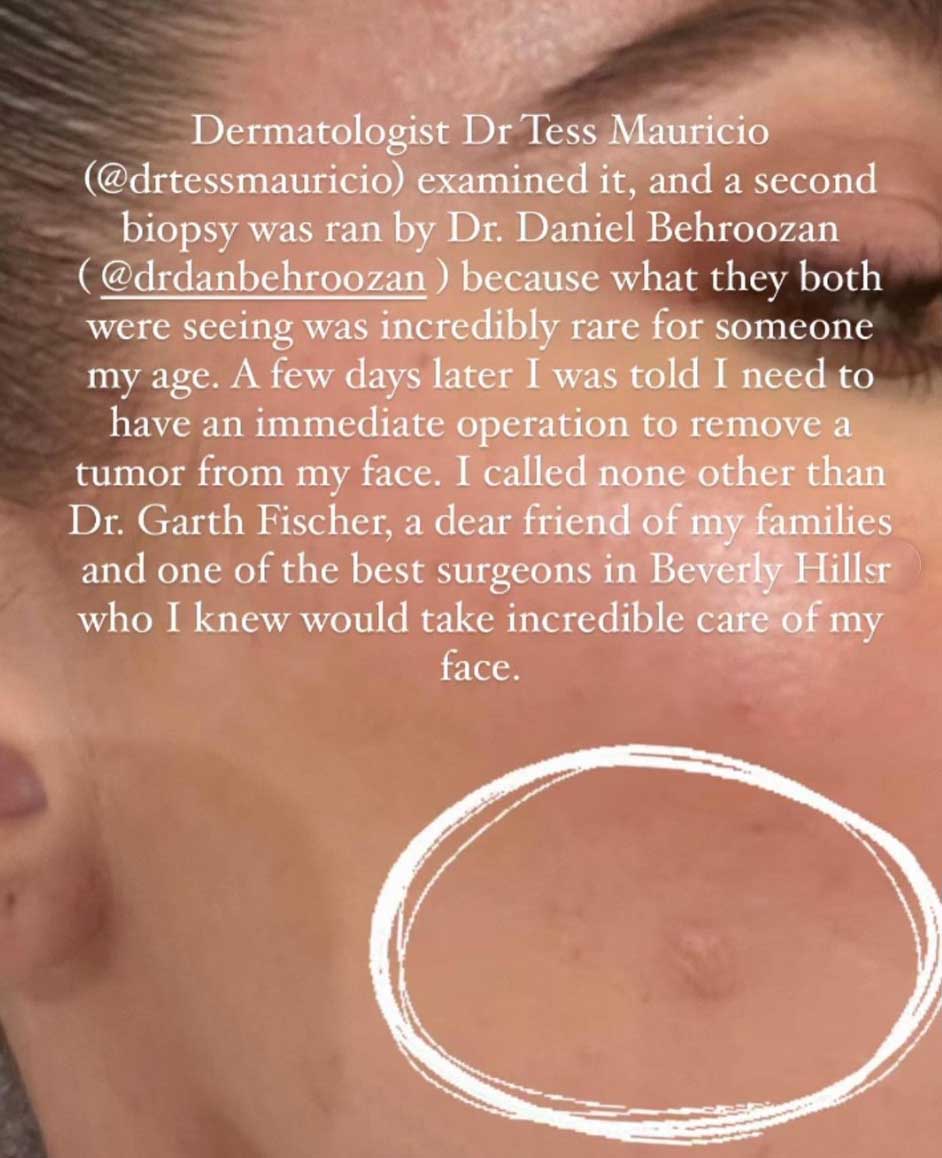 Khloé Kardashian has cancer