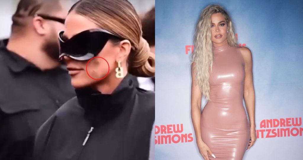 Khloé Kardashian has cancer