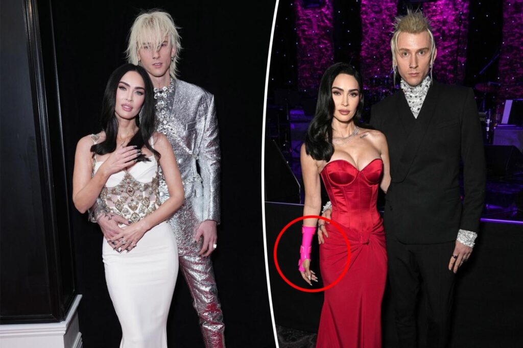 Megan Fox attended the Grammys with a brain concussion