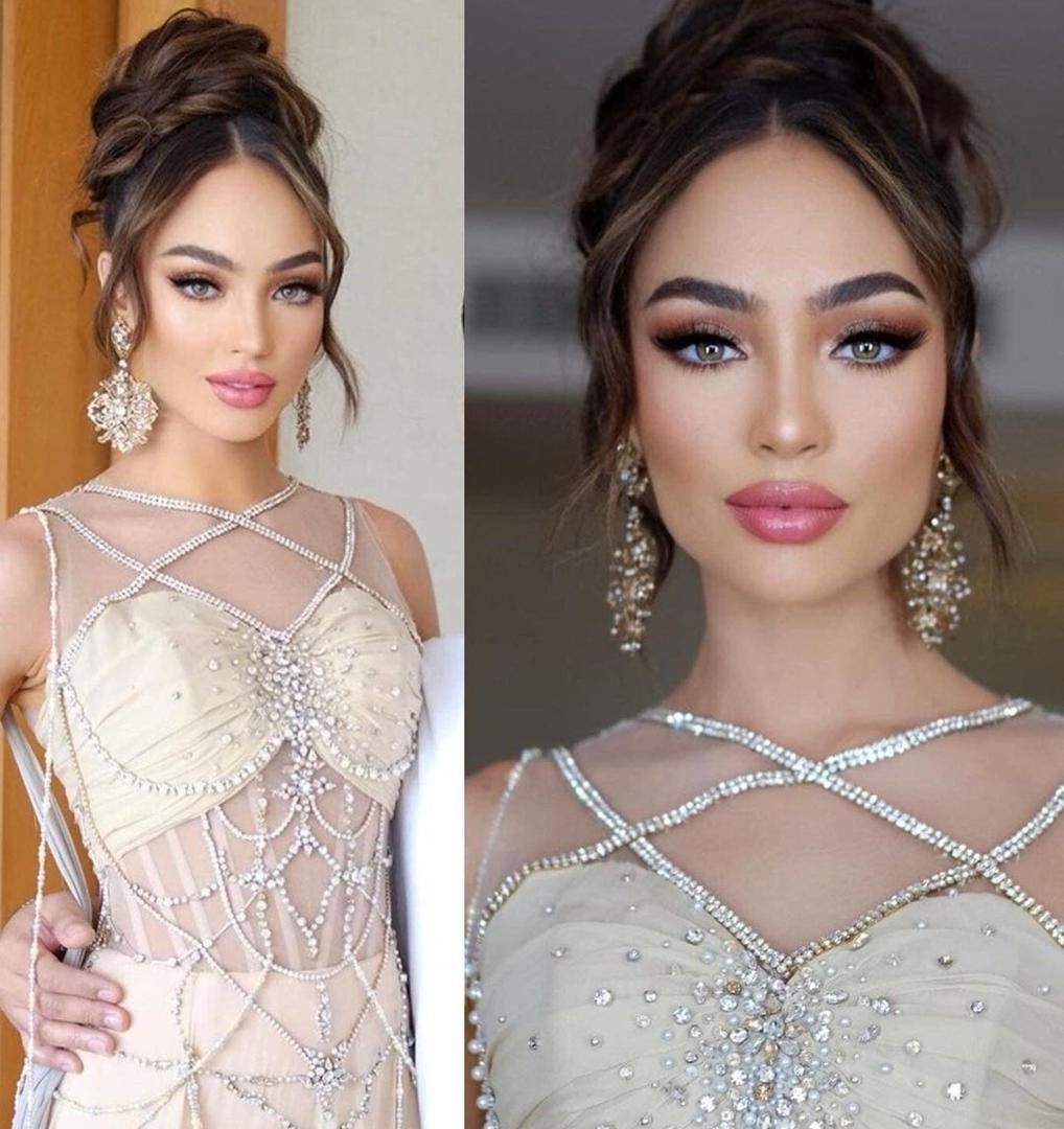 Miss Universe 2022 had face surgery and now looks unrecognizable