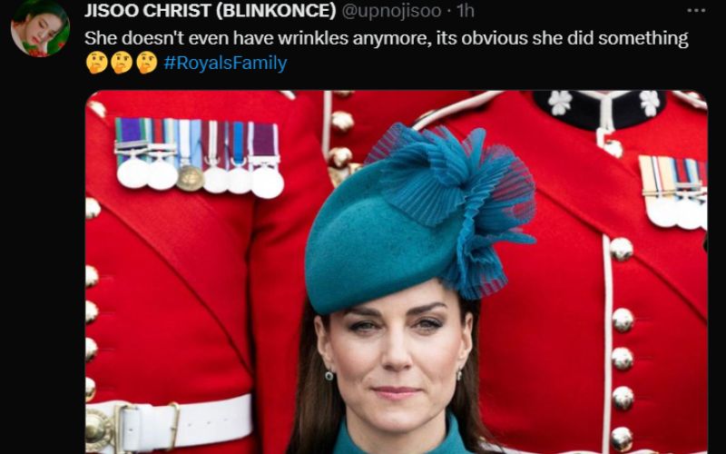 Kate Middleton undergoes surgery to win Prince William back from his mistress