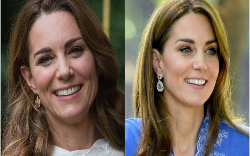 Kate Middleton’s face before and after getting botox injections to look younger