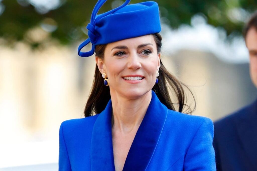 Kate Middleton’s face before and after getting botox injections to look younger