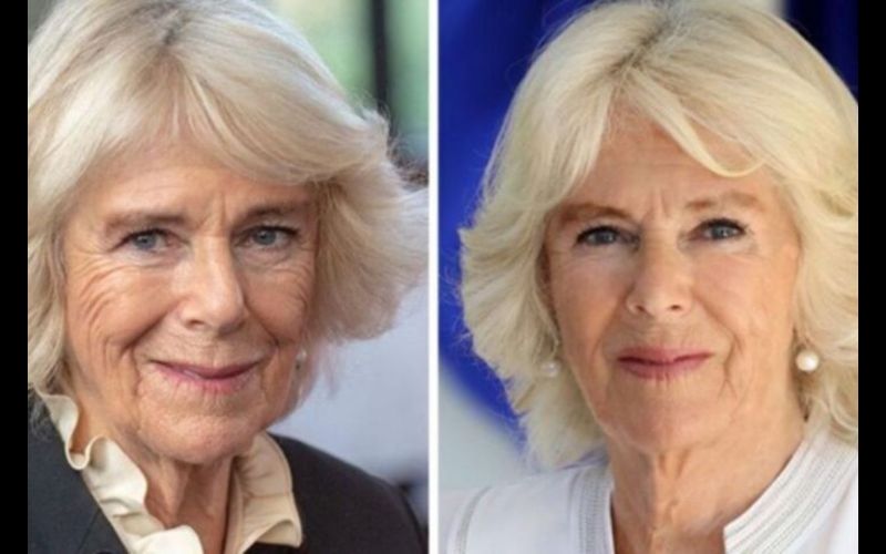 This is the fortune that Queen Consort Camilla Parker spent on her surgeries for the coronation