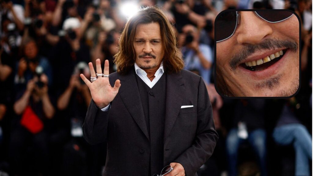 Johnny Depp causes disgust after appearing with rotten teeth at Cannes