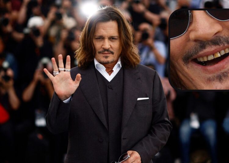 Johnny depp causes disgust after appearing with rotten teeth at cannes