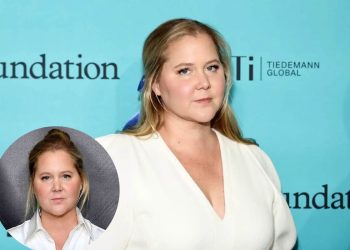 Amy Schumer has been diagnosed with Cushing's Syndrome