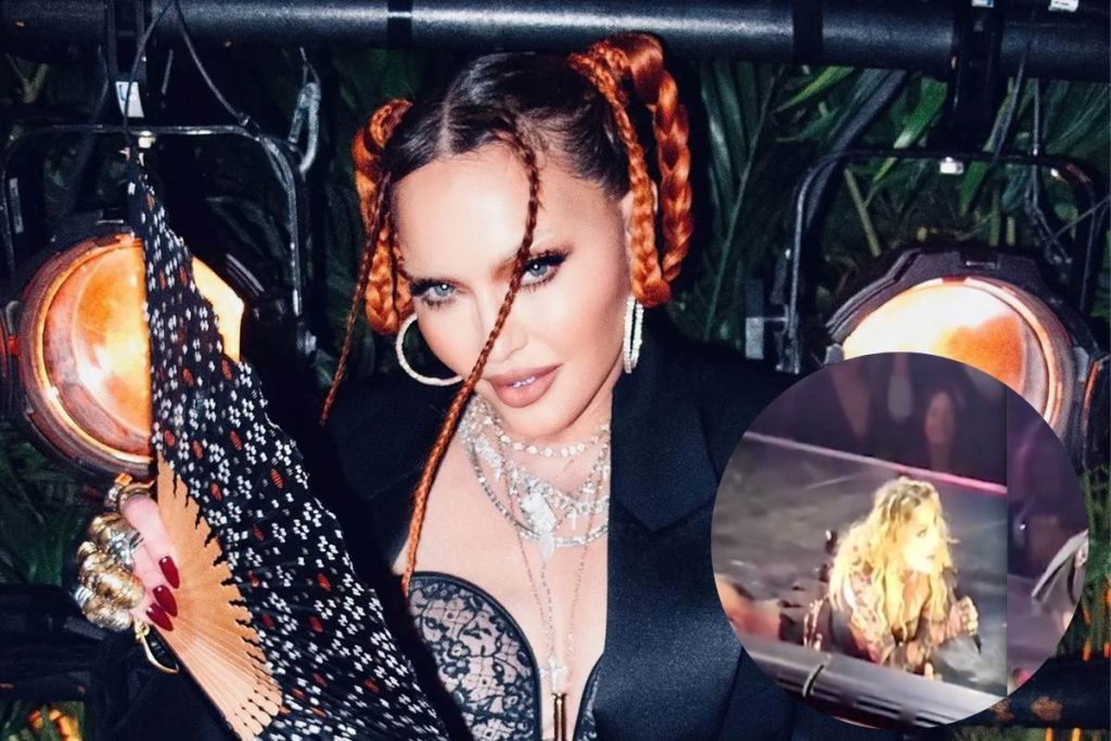 Madonna suffers accident at concert