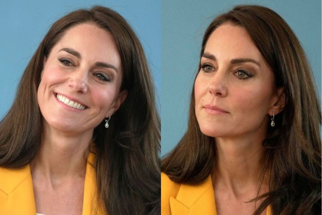 These are Kate Middleton's medical restrictions one month after her abdominal surgery