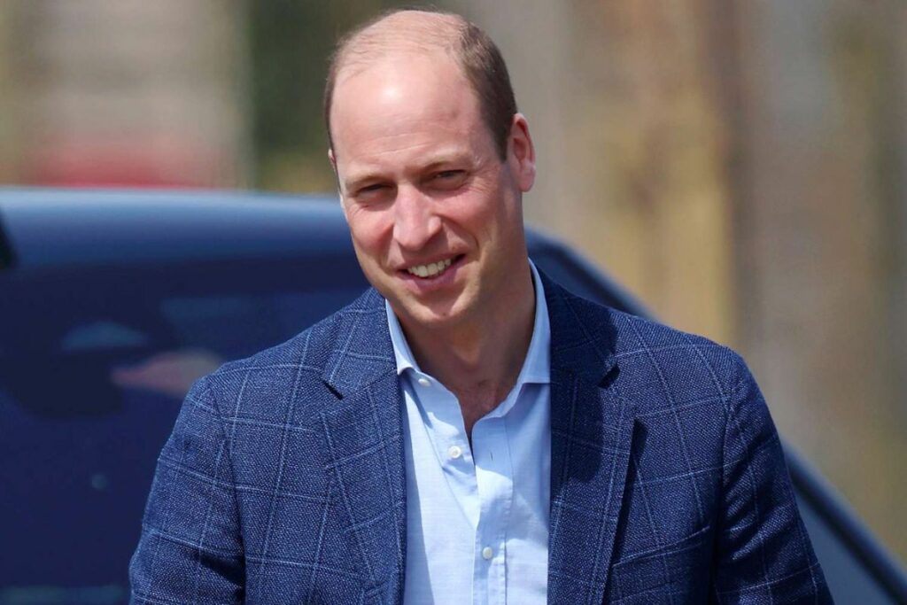 This would explain why Prince William does not get a hair implant to address his baldness