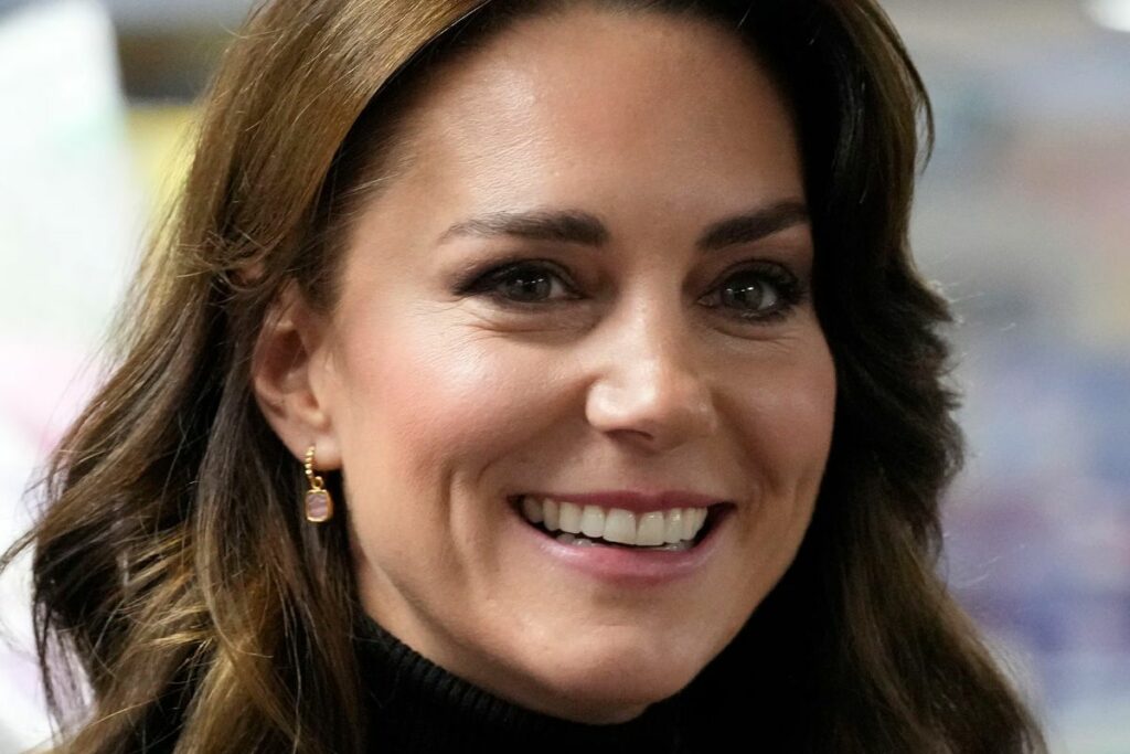 Did Kate Middleton have a facelift amid her cancer treatment