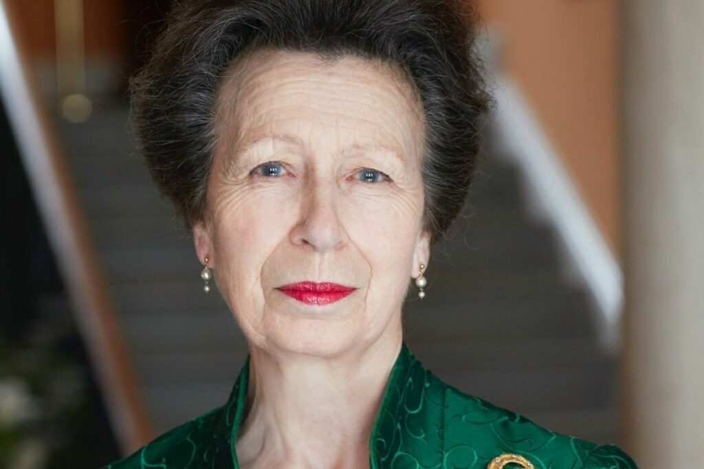 Princess Anne is suffering memory loss after a concussion