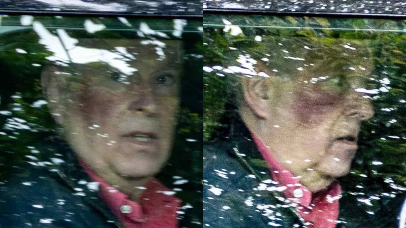 Ex-Prince Andrew appears with a facial bruise during a rare public appearance