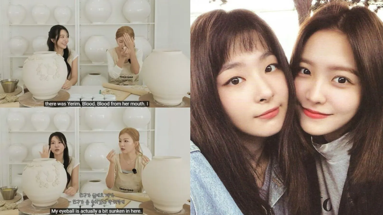 Red Velvet's Yeri and Seulgi share new details about the car accident they suffered in 2016 Red Velvet's Yeri and Seulgi share new details about the car accident they suffered in 2016