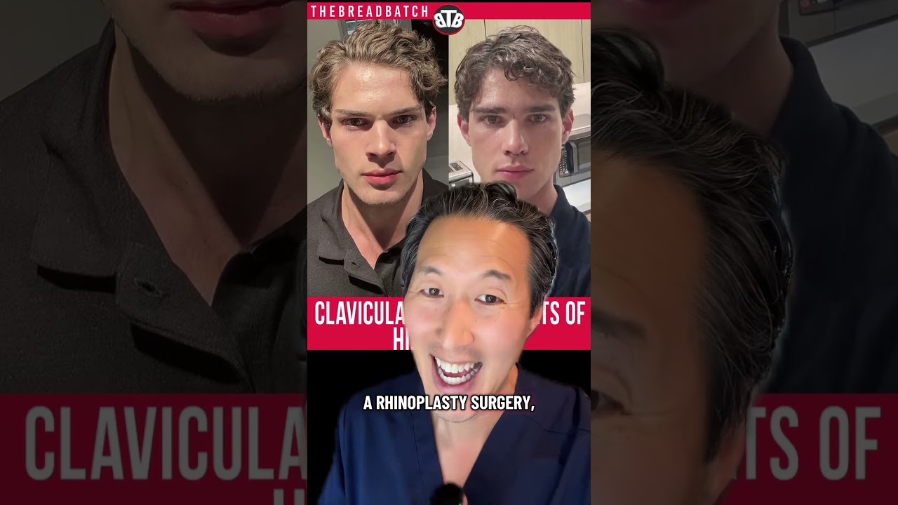 What’s the Scoop with Clavicular’s Nose Job?