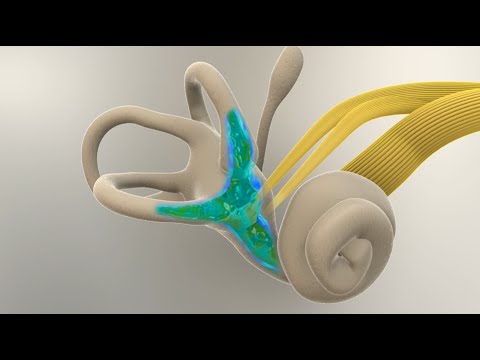 Meniere's Disease - What Happens in the Inner Ear?