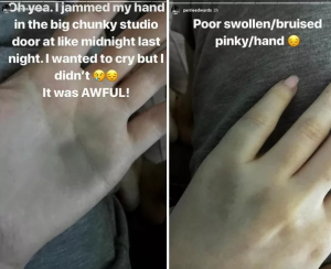 Perrie Edwards se lastimó la mano grabando el nuevo álbum de Little Mix