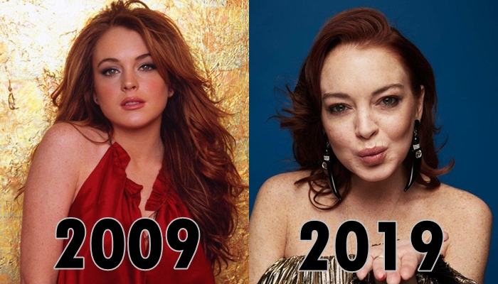 7 celebridades que arruinaron sus rostros con cirugias