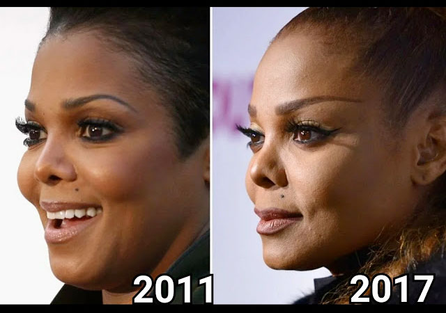 7 celebridades que arruinaron sus rostros con cirugias