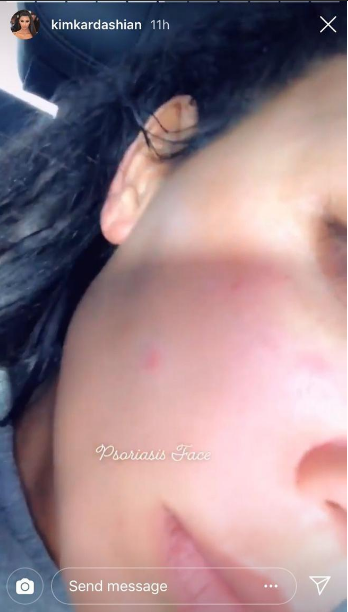 Impactantes fotografías de Kim Kardashian sin maquillaje