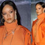 Rihanna sufre accidente y le quedan terribles moretones en toda la cara