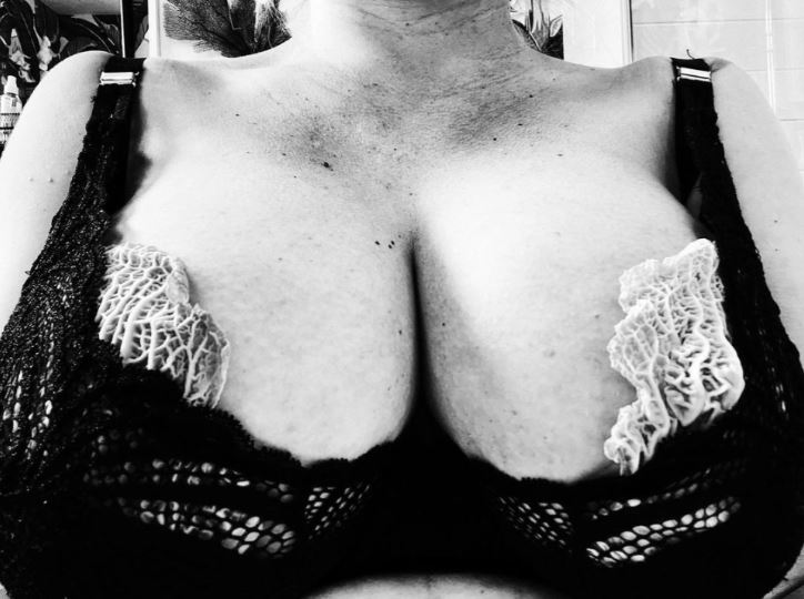 Paloma Faith se coloca repollo en los senos tras ser diagnosticada con molesta dolencia