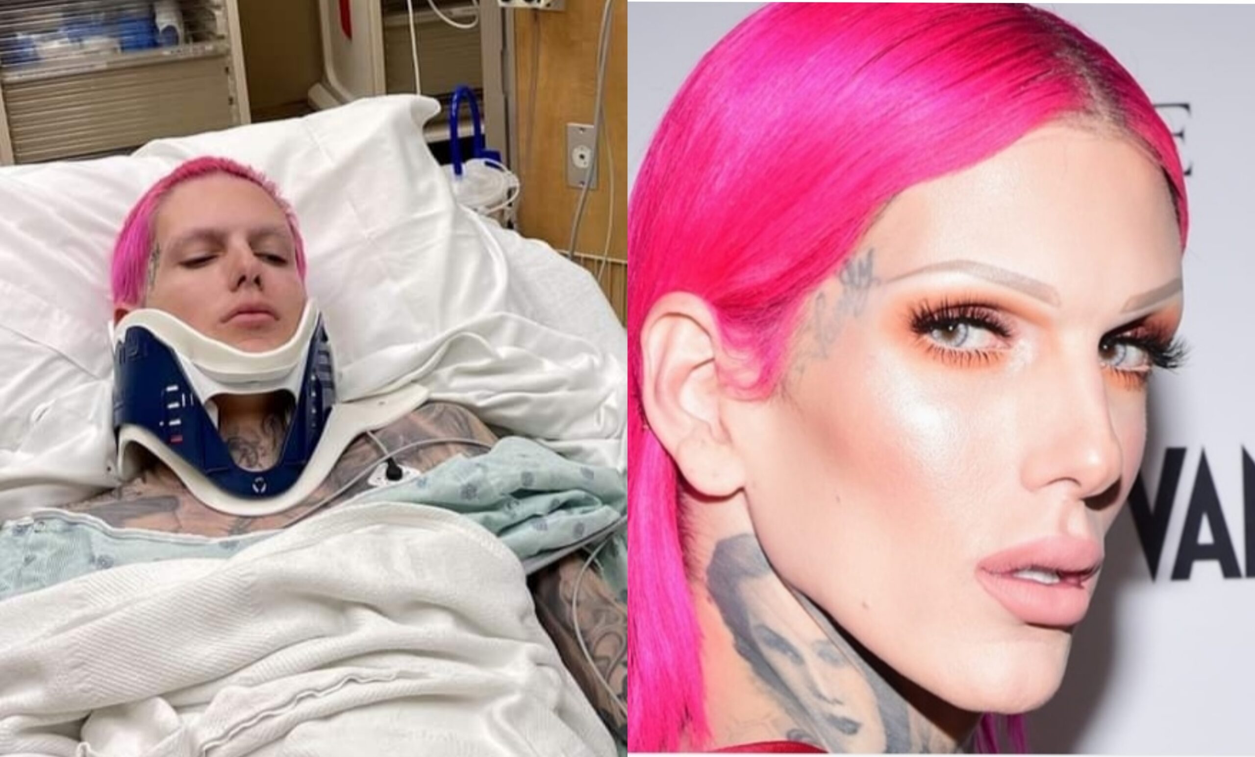 Influencer Jeffree Star hospitalizado tras terrible accidente, reporta TMZ