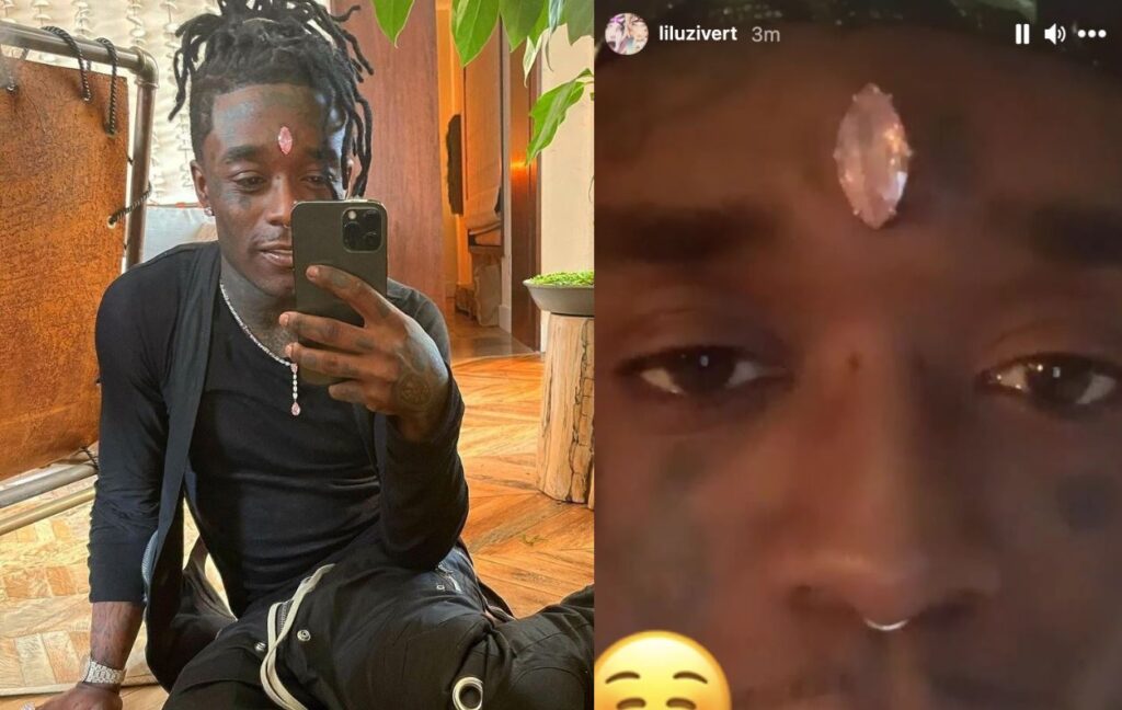 En pleno concierto a Lil Uzi Vert le arrancaron el diamante que se incrustó en la frente