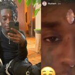 En pleno concierto a Lil Uzi Vert le arrancaron el diamante que se incrustó en la frente