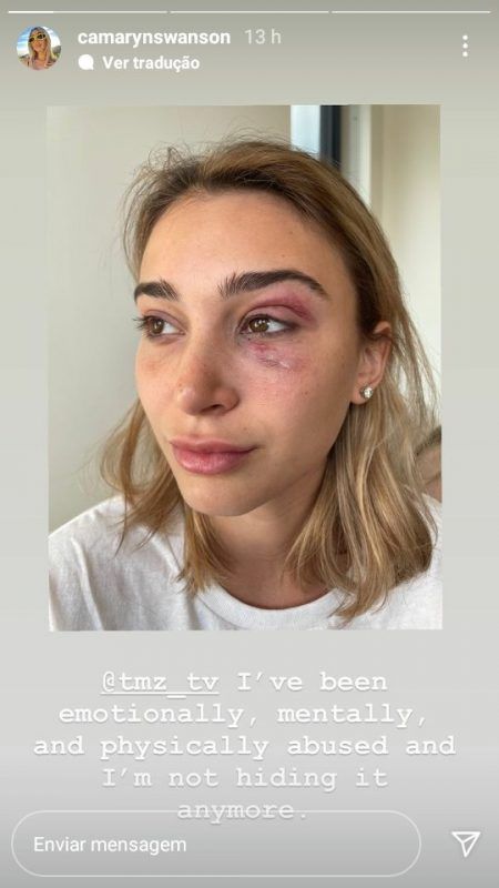 Tyga es acusado de agresión física a su ex novia