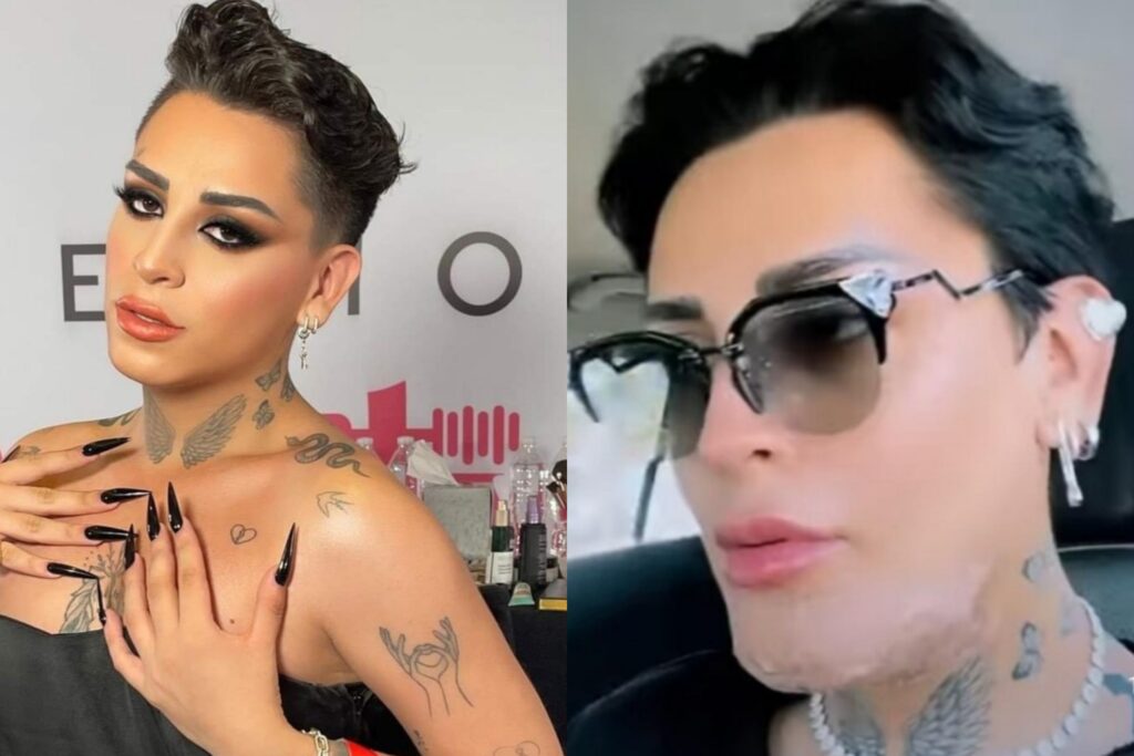 Kunno se sometió a cirugía estética y ahora ha perdido la sonrisa; "se parece a Thanos"