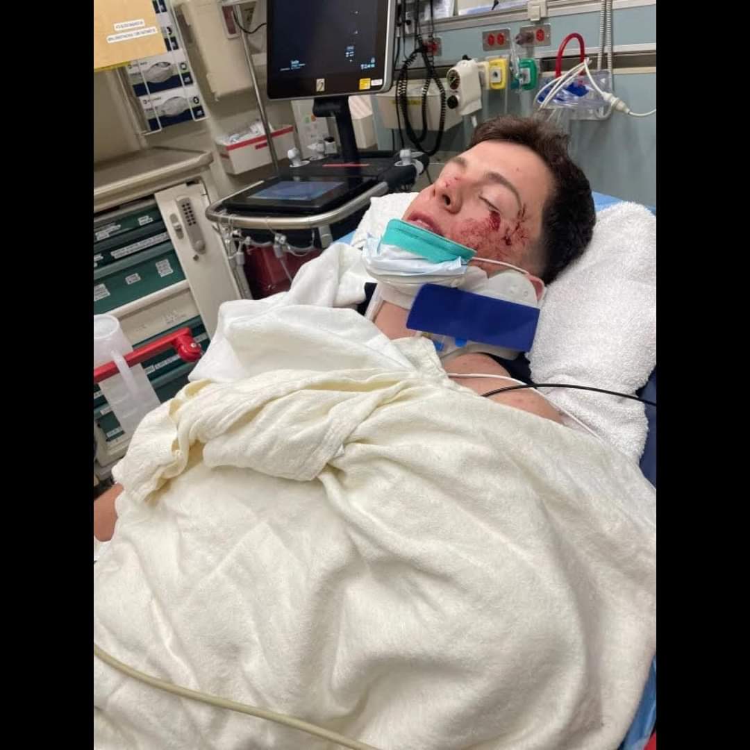 Guaynaa sufrió un grave accidente de tránsito que lo deja hospitalizado