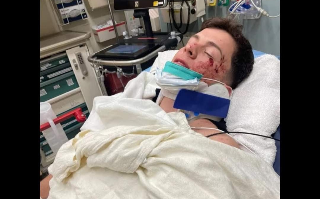 Guaynaa sufrió un grave accidente de tránsito que lo deja hospitalizado