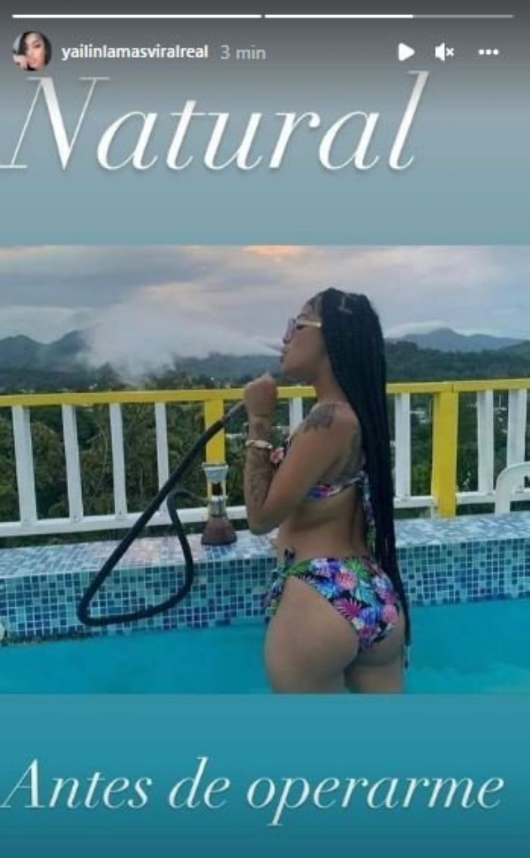 Yailin enseña como lucía antes de pasar por el quirófano y conocer a Anuel AA y nos deja atónitos