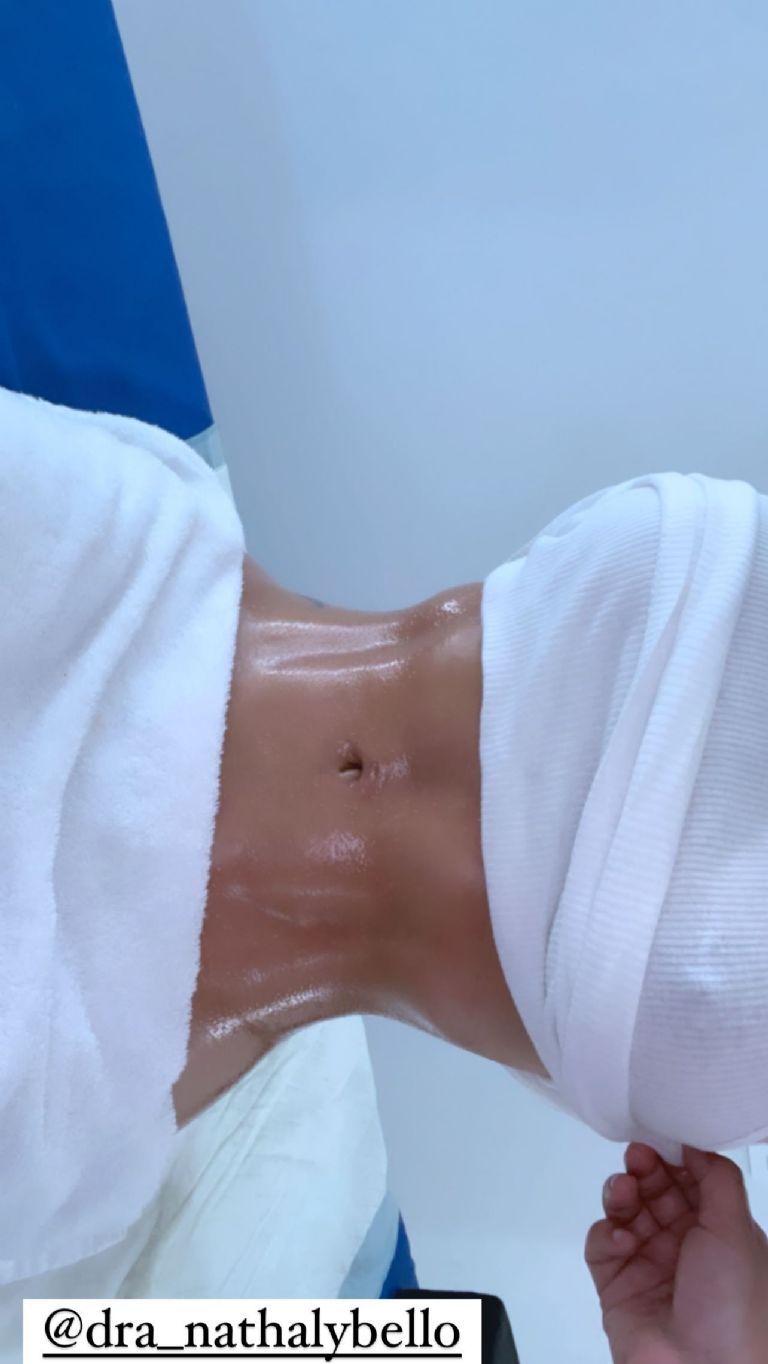 Yailin, la novia de Anuel, presume su nueva cintura y aseguran que se quitó las costillas