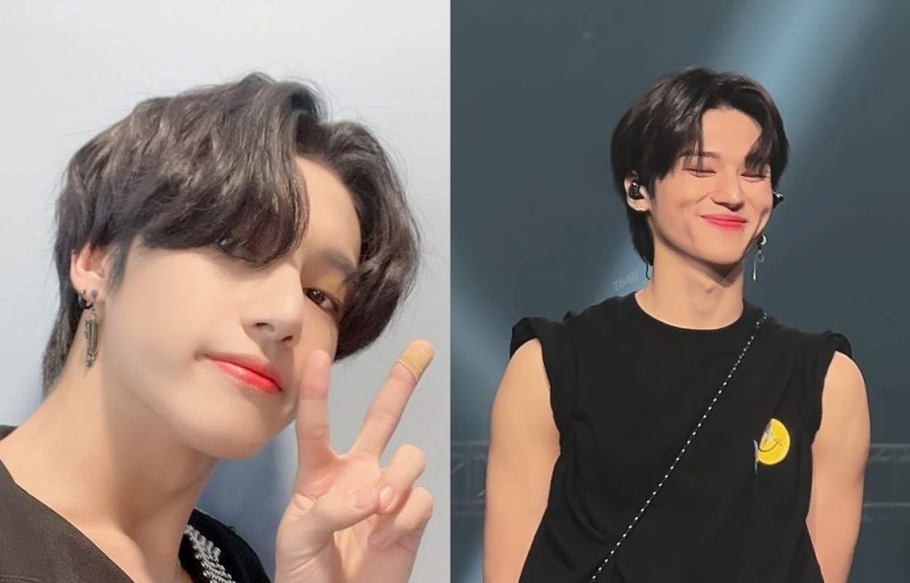 Wooyoung de ATEEZ sufre fuerte lesión de espalda durante concierto en España