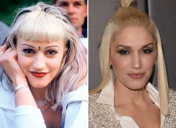 ¿Gwen Stefani se operó la cara?