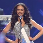 Así luce ahora Miss Universo 2022 tras someterse a un tratamiento de botox