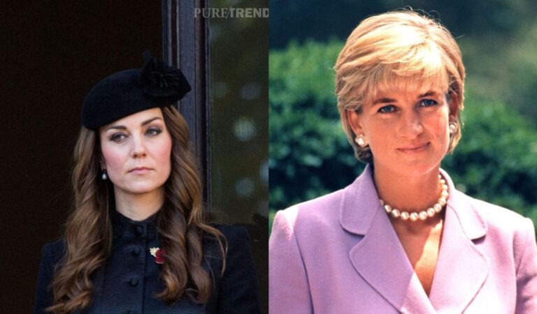 Kate Middleton y la Princesa Diana sufren del mismo problema