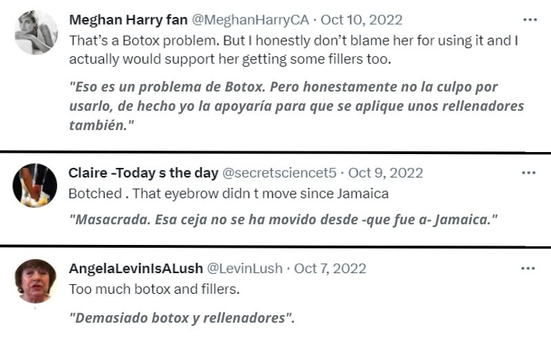 El príncipe William reacciona a las cirugías plásticas de Kate Middleton