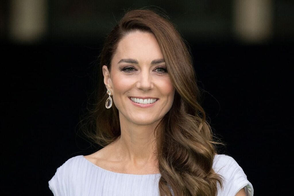 Kate Middleton se inyectó botox en su rostro y el resultado es impresionante