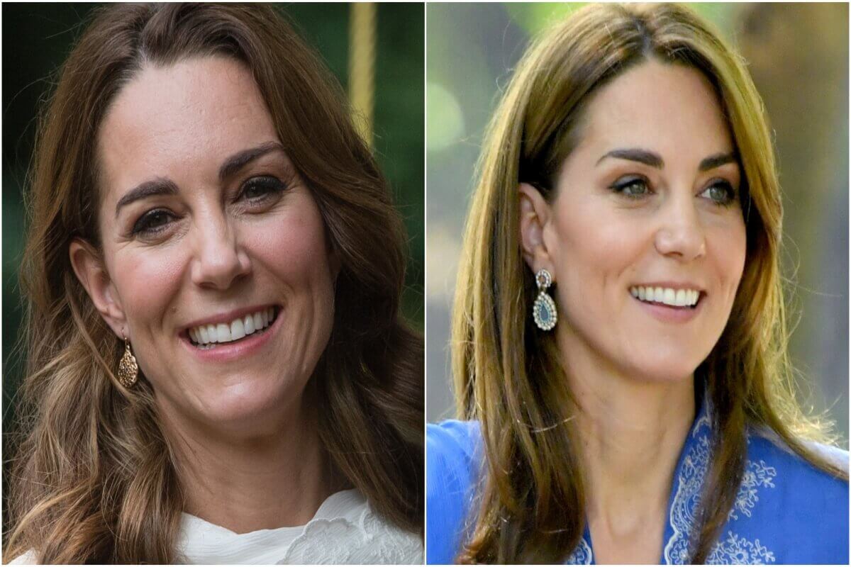 Kate Middleton se inyectó botox en su rostro y el resultado es impresionante