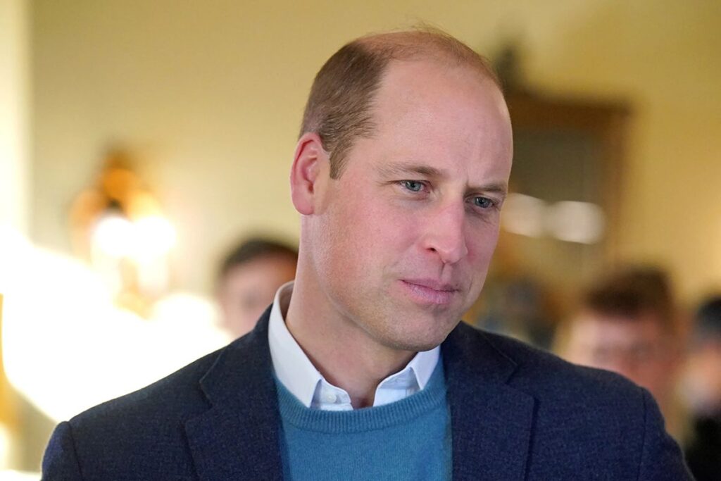 El príncipe William muestra sus encantos físicos al dejar sus piernas al descubierto