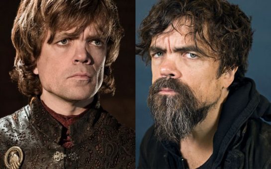 El cambio físico que el actor Peter Dinklage (Tyrion Lannister) tuvo ...