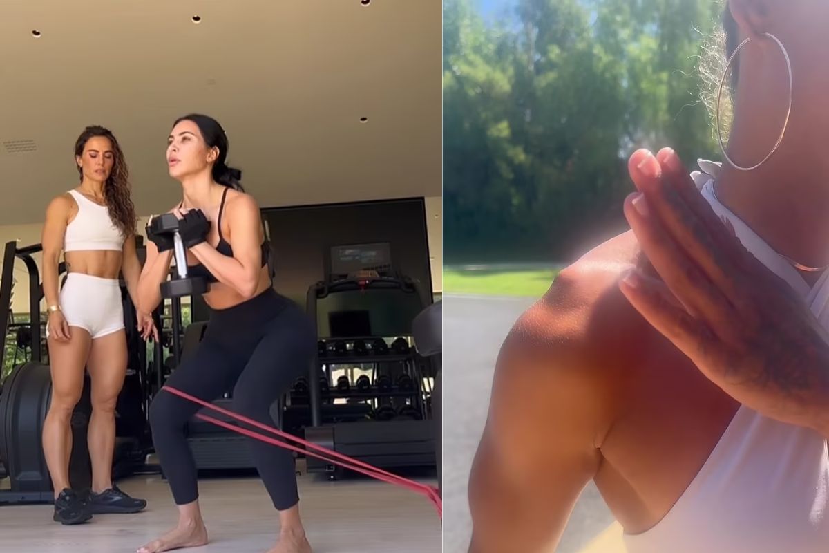Kim Kardashian sufrió un terrible accidente en su brazo que preocupó a sus fans