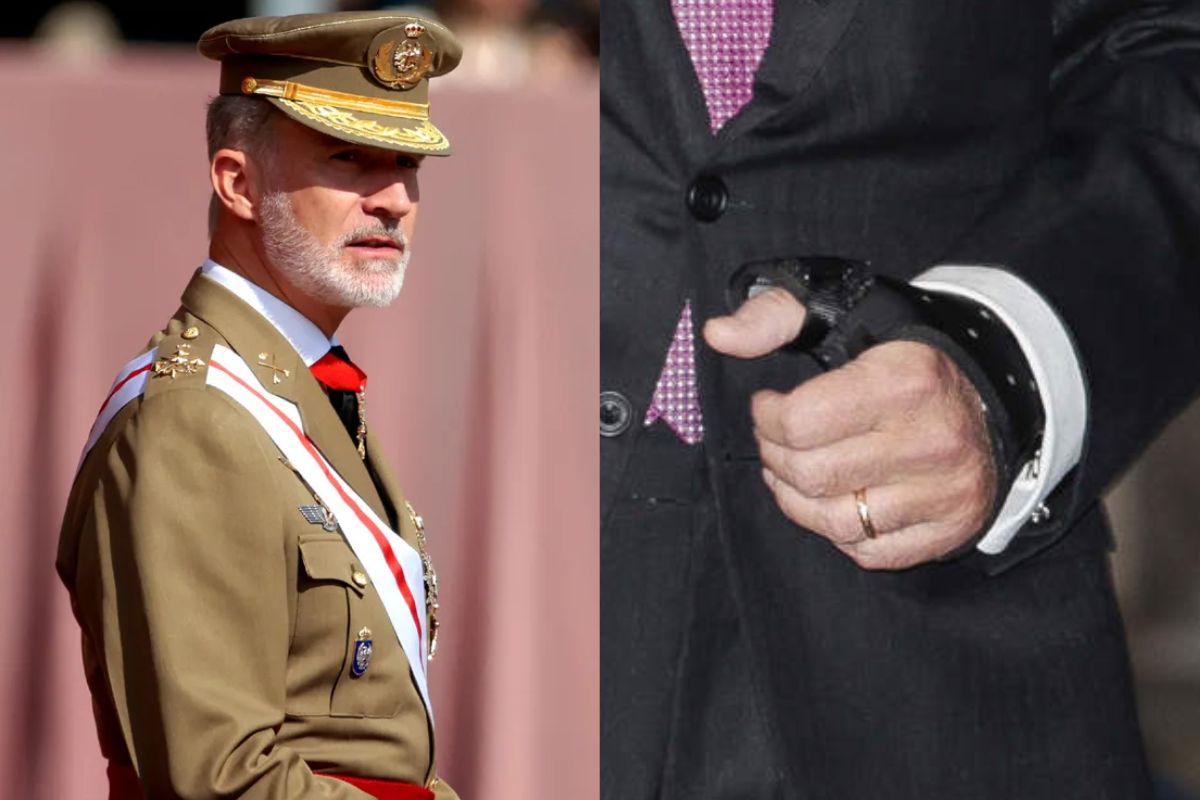 El motivo por el que el rey Felipe VI ha tenido que ser intervenido quirúrgicamente