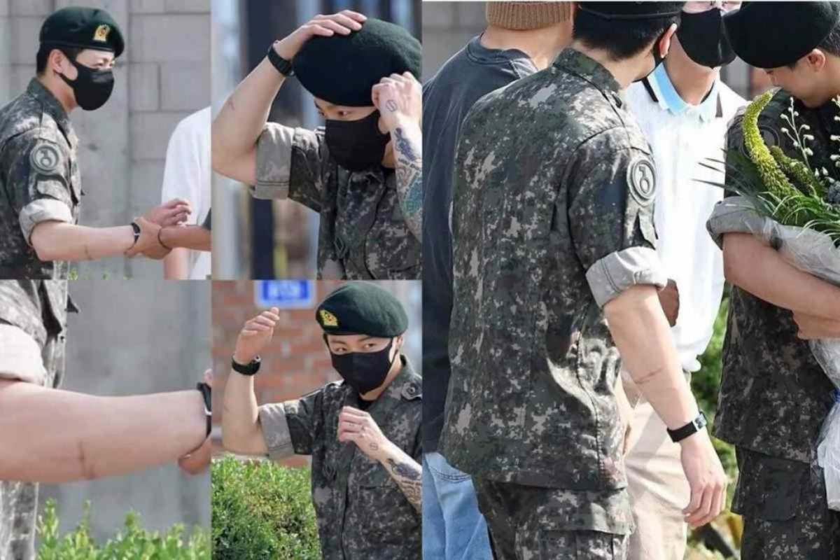 Jungkook de BTS aparece con una impactante cicatriz y genera preocupación entre sus fans