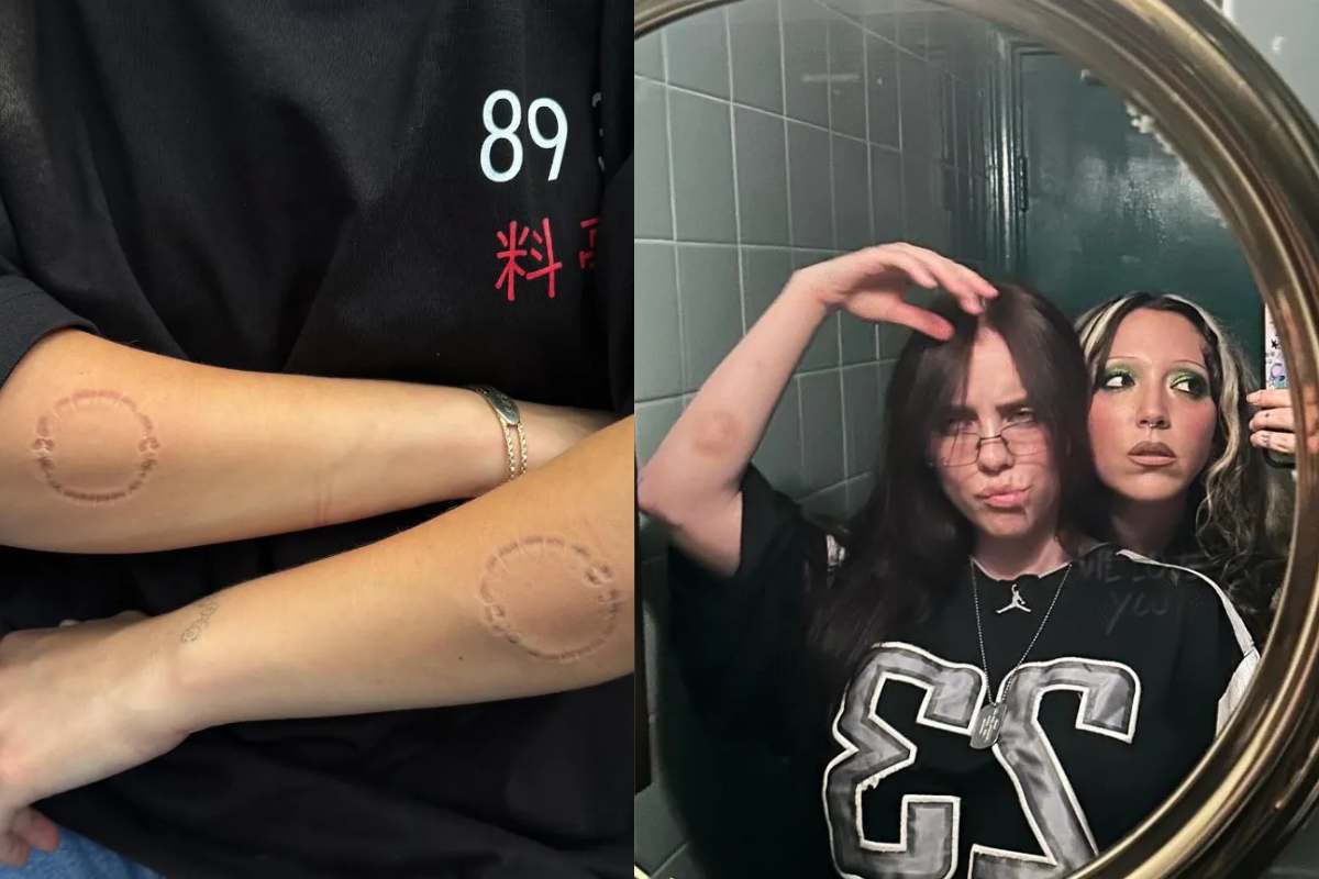Billie Eilish preocupa a sus fans al estar cubierta de mordidas y moretones en su cuerpo